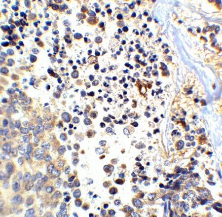 Immunohistochemistry (Formalin/PFA-fixed paraffin-embedded sections) - Anti-Amyloid Precursor Protein antibody (AB2072)