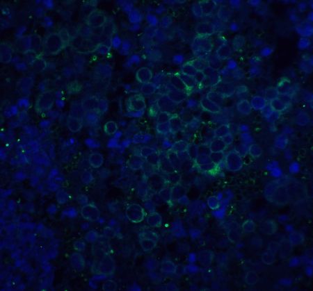 Immunohistochemistry (Formalin/PFA-fixed paraffin-embedded sections) - Anti-Amyloid Precursor Protein antibody (AB2072), expandable thumbnail