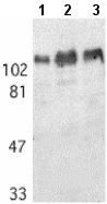 Western blot - Anti-Amyloid Precursor Protein antibody (AB2072), expandable thumbnail