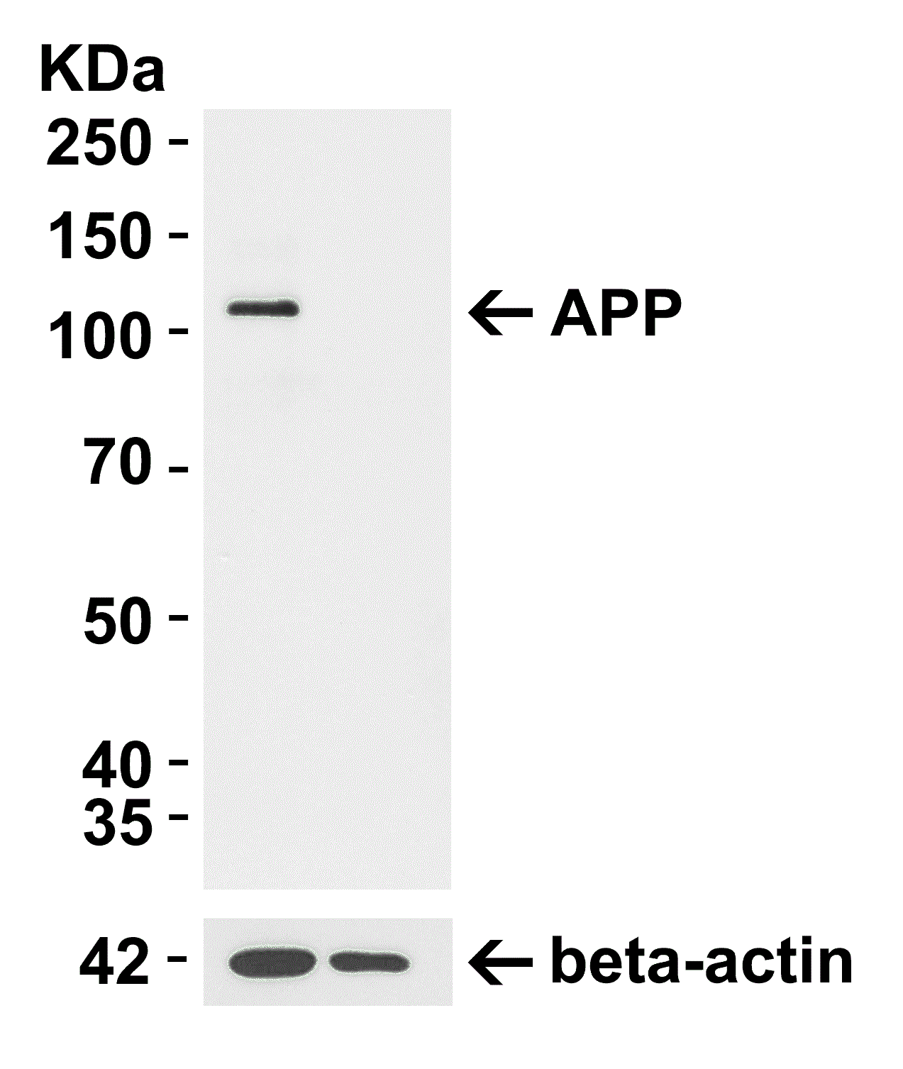 Western blot - Anti-Amyloid Precursor Protein antibody (AB2072), expandable thumbnail