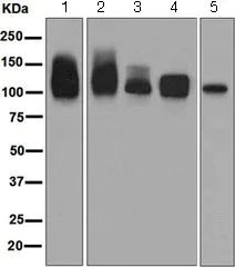 Western blot - Anti-Amyloid Precursor Protein antibody [EPR5118-34] (AB126732)