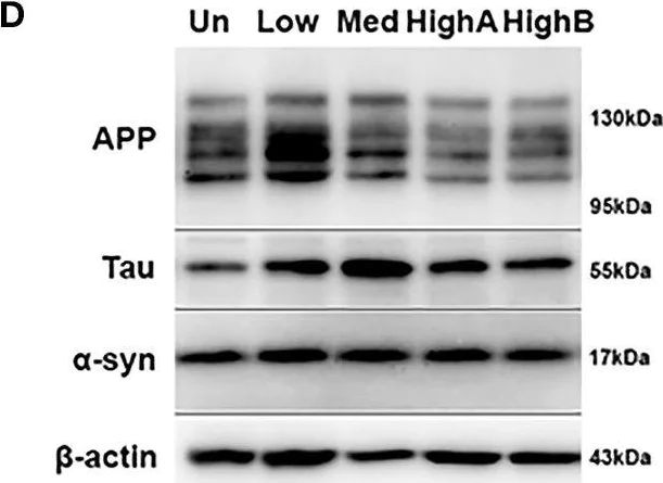 Western blot - Anti-Amyloid Precursor Protein antibody [EPR5118-34] (AB126732)