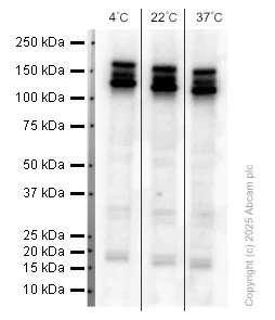 Western blot - Anti-Amyloid Precursor Protein antibody [EPR5118-34] (AB126732)
