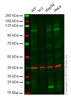 Western blot - Anti-Amyloid Precursor Protein antibody [EPR5118] (AB133509)