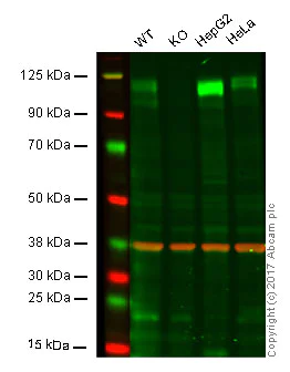 Western blot - Anti-Amyloid Precursor Protein antibody [EPR5119(2)] (AB133588)