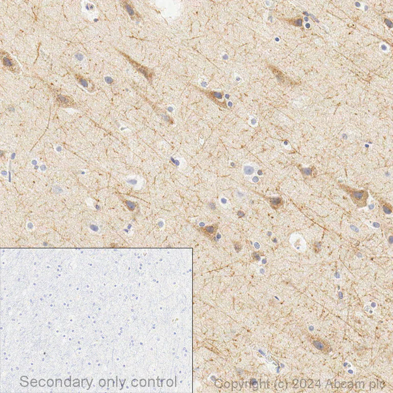 Immunohistochemistry (Formalin/PFA-fixed paraffin-embedded sections) - Anti-Amyloid Precursor Protein antibody [Y188] (AB32136)