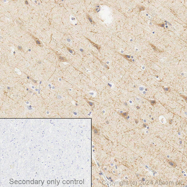 Immunohistochemistry (Formalin/PFA-fixed paraffin-embedded sections) - Anti-Amyloid Precursor Protein antibody [Y188] (AB32136)