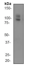 Western blot - Anti-Amyloid Precursor Protein antibody [Y188] (AB32136)