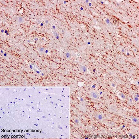 Immunohistochemistry (Formalin/PFA-fixed paraffin-embedded sections) - Anti-Amyloid Precursor Protein antibody [Y188] - BSA and Azide free (AB256586)