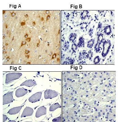 Immunohistochemistry (Formalin/PFA-fixed paraffin-embedded sections) - Anti-Amyloid Precursor Protein antibody [Y188] - BSA and Azide free (AB256586)