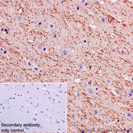 Anti-Amyloid Precursor Protein antibody [Y188] - Low