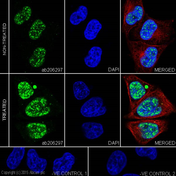 Immunocytochemistry/ Immunofluorescence - Anti-Amyloid Precursor Protein (phospho T743) antibody [EPR7074(N)] (ab206297), expandable thumbnail