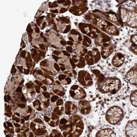 Immunohistochemistry (Formalin/PFA-fixed paraffin-embedded sections) - Anti-ANAPC13 antibody (AB151216)