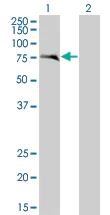 Western blot - ANAPC2 overexpression 293T lysate (whole cell) (AB94319)