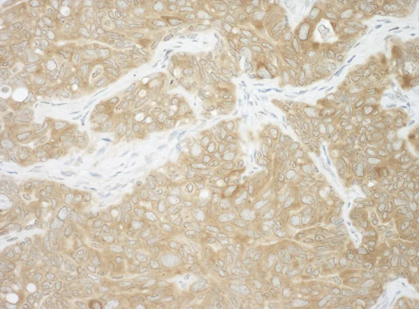 Immunohistochemistry (Formalin/PFA-fixed paraffin-embedded sections) - Anti-Ancient ubiquitous protein 1 antibody (AB101984)