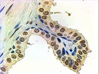Immunohistochemistry (Formalin/PFA-fixed paraffin-embedded sections) - Anti-Androgen Receptor antibody (AB19066)
