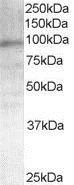 Western blot - Anti-Androgen Receptor antibody (AB19066)