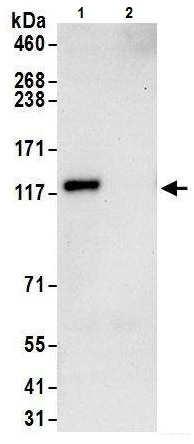 Immunoprecipitation - Anti-Androgen Receptor antibody (AB226171)