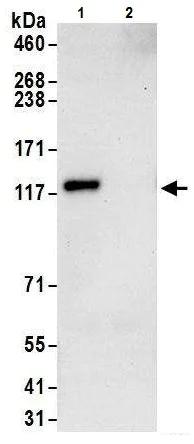 Immunoprecipitation - Anti-Androgen Receptor antibody (AB226171)