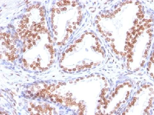 Immunohistochemistry (Formalin/PFA-fixed paraffin-embedded sections) - Anti-Androgen Receptor antibody [DHTR/882] - BSA and Azide free (AB212500)
