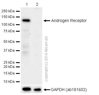 Western blot - Anti-Androgen Receptor antibody [EP670Y] (AB52615)