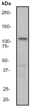 Western blot - Anti-Androgen Receptor antibody [EP670Y] (AB52615), expandable thumbnail