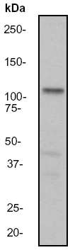 Western blot - Anti-Androgen Receptor antibody [EP670Y] (AB52615)
