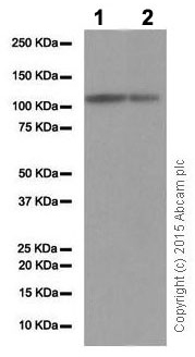 Western blot - Anti-Androgen Receptor antibody [EP670Y] (AB52615), expandable thumbnail