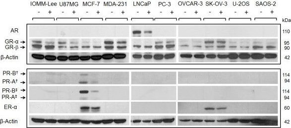 Western blot - Anti-Androgen Receptor antibody [EP670Y] (ab52615), expandable thumbnail