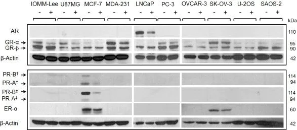 Western blot - Anti-Androgen Receptor antibody [EP670Y] (AB52615)