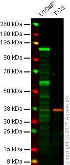 Western blot - Anti-Androgen Receptor antibody [EP670Y] (AB52615)