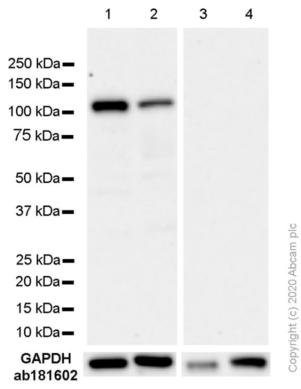 Western blot - Anti-Androgen Receptor antibody [EP670Y] - BSA and Azide free (AB208088)