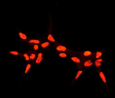 Immunocytochemistry/ Immunofluorescence - Anti-Androgen Receptor antibody [EPR1535(2)] (ab133273), expandable thumbnail