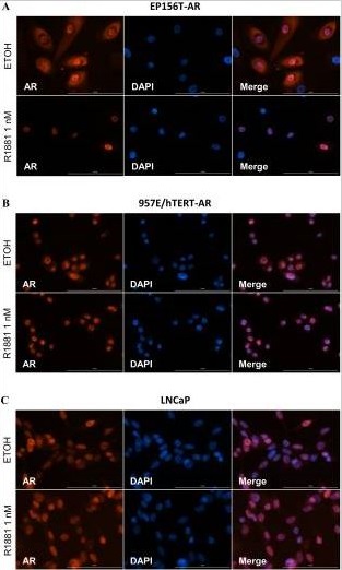 Immunocytochemistry/ Immunofluorescence - Anti-Androgen Receptor antibody [EPR1535(2)] (AB133273), expandable thumbnail