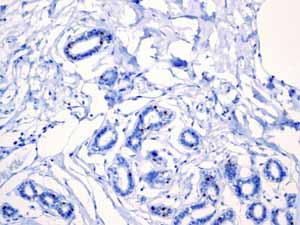 Immunohistochemistry (Formalin/PFA-fixed paraffin-embedded sections) - Anti-Androgen Receptor antibody [EPR1535(2)] (ab133273), expandable thumbnail