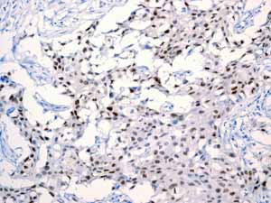 Immunohistochemistry (Formalin/PFA-fixed paraffin-embedded sections) - Anti-Androgen Receptor antibody [EPR1535(2)] (ab133273), expandable thumbnail