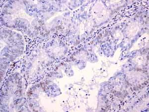 Immunohistochemistry (Formalin/PFA-fixed paraffin-embedded sections) - Anti-Androgen Receptor antibody [EPR1535(2)] (ab133273), expandable thumbnail