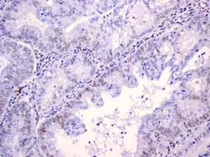 Immunohistochemistry (Formalin/PFA-fixed paraffin-embedded sections) - Anti-Androgen Receptor antibody [EPR1535(2)] (AB133273)