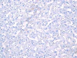 Immunohistochemistry (Formalin/PFA-fixed paraffin-embedded sections) - Anti-Androgen Receptor antibody [EPR1535(2)] (ab133273), expandable thumbnail