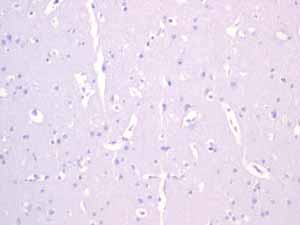 Immunohistochemistry (Formalin/PFA-fixed paraffin-embedded sections) - Anti-Androgen Receptor antibody [EPR1535(2)] (ab133273), expandable thumbnail