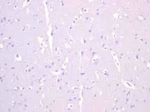 Immunohistochemistry (Formalin/PFA-fixed paraffin-embedded sections) - Anti-Androgen Receptor antibody [EPR1535(2)] (AB133273)