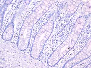 Immunohistochemistry (Formalin/PFA-fixed paraffin-embedded sections) - Anti-Androgen Receptor antibody [EPR1535(2)] (ab133273), expandable thumbnail