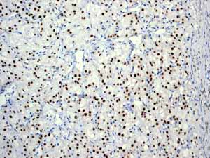 Immunohistochemistry (Formalin/PFA-fixed paraffin-embedded sections) - Anti-Androgen Receptor antibody [EPR1535(2)] (ab133273), expandable thumbnail