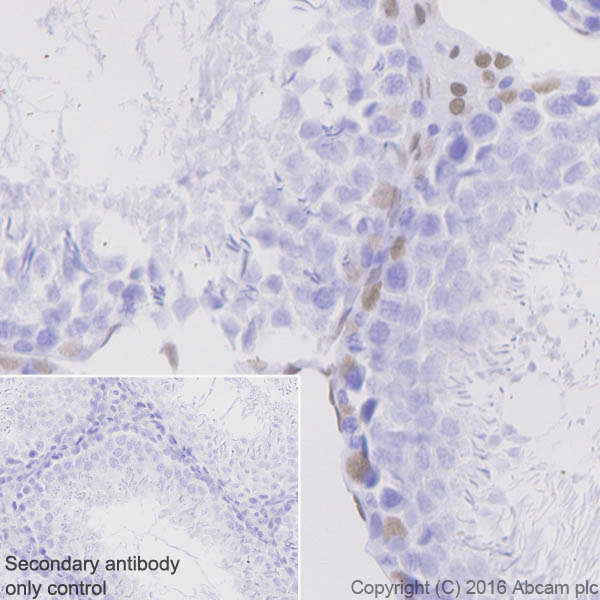 Immunohistochemistry (Formalin/PFA-fixed paraffin-embedded sections) - Anti-Androgen Receptor antibody [EPR1535(2)] (ab133273), expandable thumbnail
