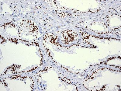 Immunohistochemistry (Formalin/PFA-fixed paraffin-embedded sections) - Anti-Androgen Receptor antibody [EPR1535(2)] (ab133273), expandable thumbnail