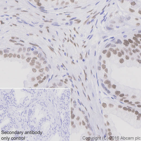 Immunohistochemistry (Formalin/PFA-fixed paraffin-embedded sections) - Anti-Androgen Receptor antibody [EPR1535(2)] (ab133273), expandable thumbnail