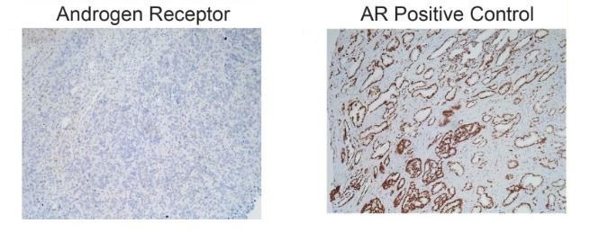 Immunohistochemistry (Formalin/PFA-fixed paraffin-embedded sections) - Anti-Androgen Receptor antibody [EPR1535(2)] (AB133273), expandable thumbnail