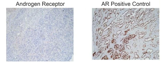 Immunohistochemistry (Formalin/PFA-fixed paraffin-embedded sections) - Anti-Androgen Receptor antibody [EPR1535(2)] (AB133273)