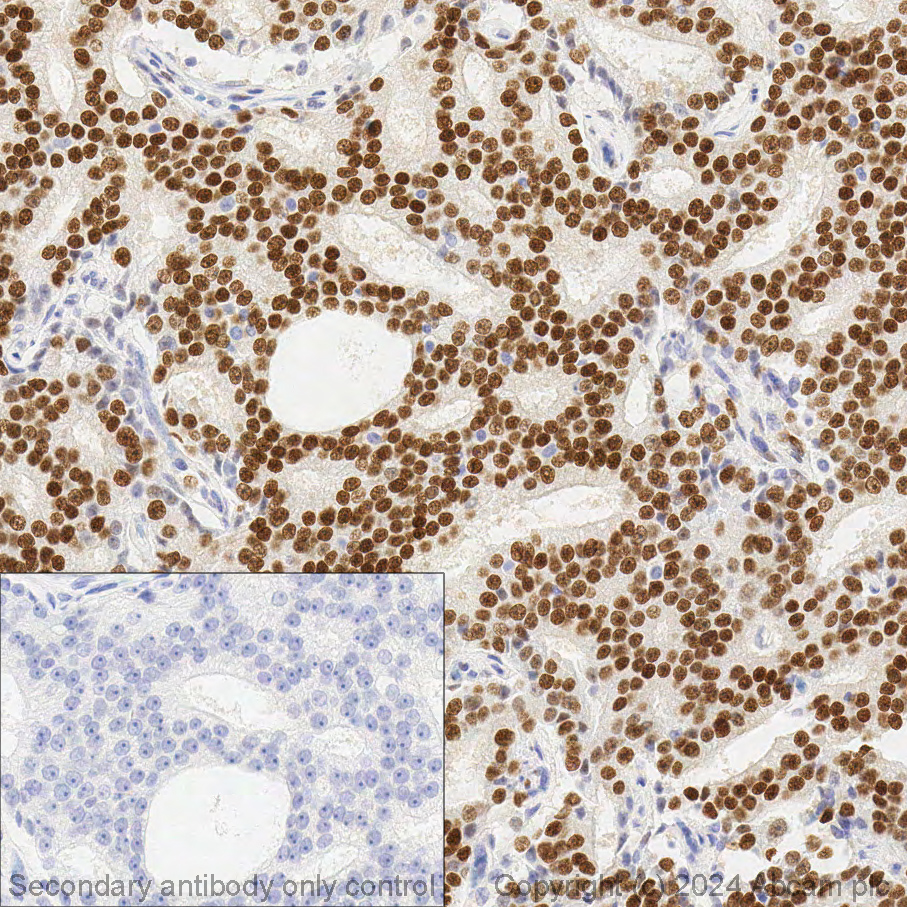 Immunohistochemistry (Formalin/PFA-fixed paraffin-embedded sections) - Anti-Androgen Receptor antibody [EPR1535(2)] (AB133273), expandable thumbnail