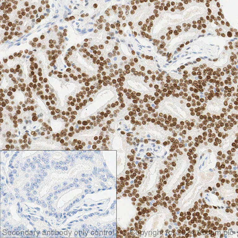 Immunohistochemistry (Formalin/PFA-fixed paraffin-embedded sections) - Anti-Androgen Receptor antibody [EPR1535(2)] (AB133273)